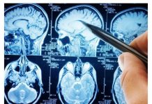 POVRĆE JE TOLIKO ZDRAVO DA O NJEMU PIŠE NJUJORK TAJMS: Amerikanci daju po 30 dolara za jedan list, a ono raste kod nas