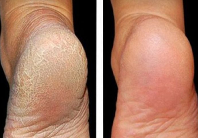 5be2fefc-3210-46db-955f-4ca10a0a0a67-pete-690x480-1